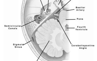 An axial view of the skull through the level of the of the internal auditory canal and cerebellopontine angle.