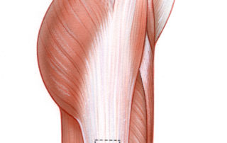 Fascia can also be obtained when the fat graft is taken from the hip region. A fairly good fascial layer can be harvested from over the gluteus medius muscle. When a large sheet of fascia is needed, such as following a major cranial base resection, the fascia lata can be taken.