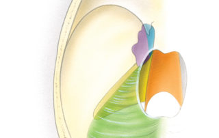 (B) The anatomy of Meckel’s cave as seen from above. The dural surfaces related to Meckel’s cave (violet) include: the tentorium (green), the posterior petrous face (yellow), the clivus (orange), and the lateral wall of the cavernous sinus (blue).