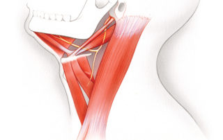 The important landmarks in the surgical anatomy of the hypoglossal nerve include its close relationship to the undersurface of the posterior belly of the digastric muscle in the floor of the submandibular triangle. The ansa cervicalis, which innervates the strap muscles, branches off of the main nerve trunk posteriorly. (12, hypoglossal nerve; MH, mylohyoid muscle; HB, hyoid bone; SM, strap muscles; SM, styloid muscles; DM digastric muscle; A, ansa cervicalis; SCM, sternocleidomastoid muscle.)